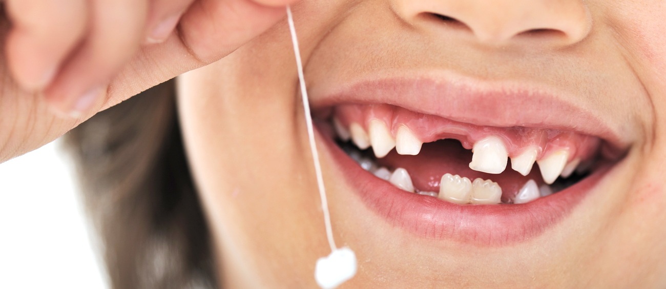 Выпадение молочных зубов: информация для родителей