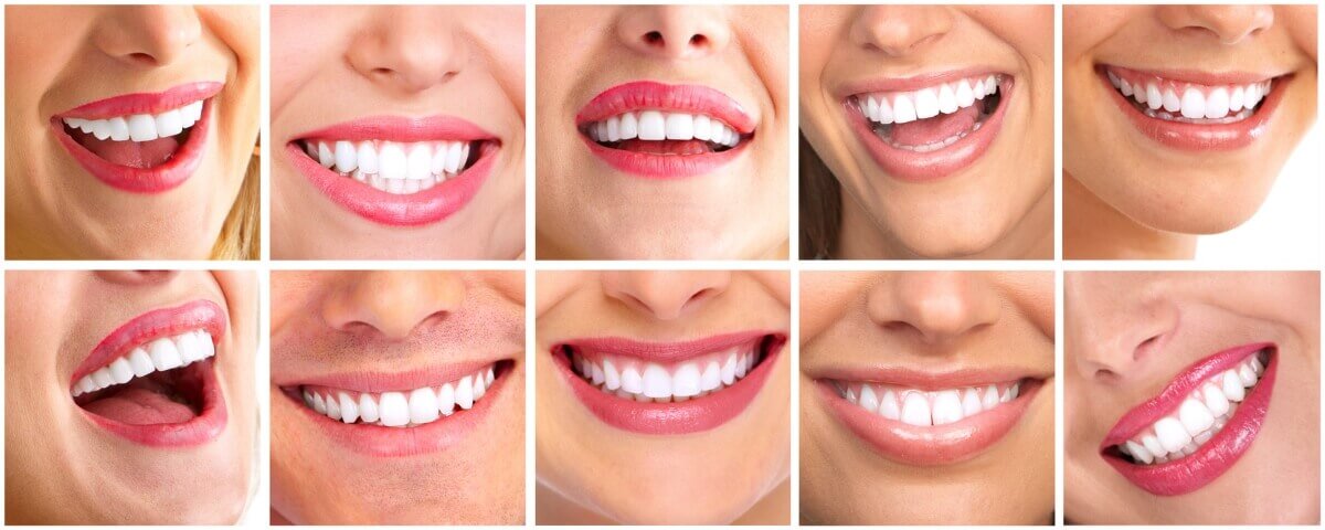 Эстетическая реставрация зубов в Семейном стоматологе